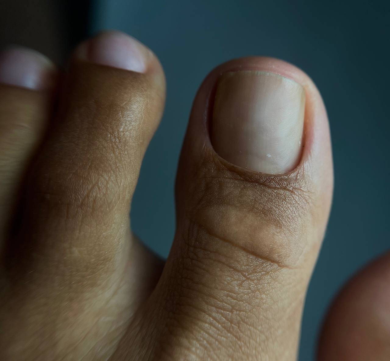 PEDICURE